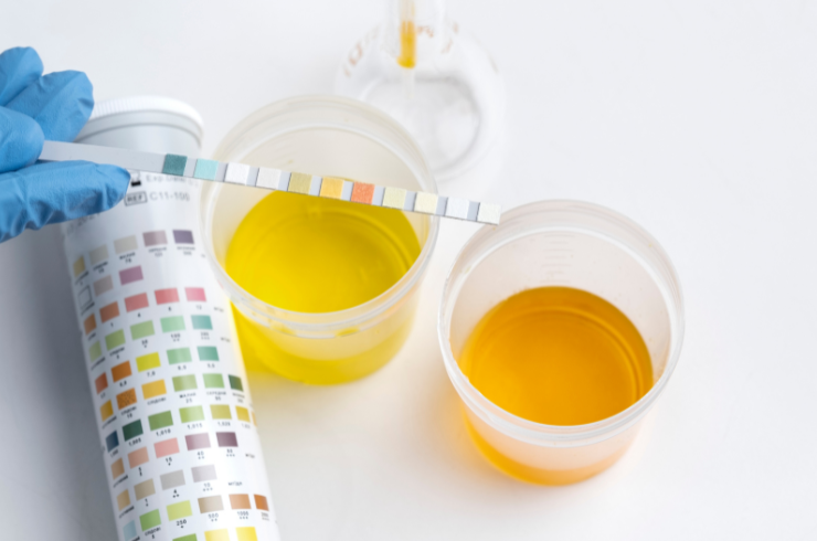 Urine & Stool Analysis